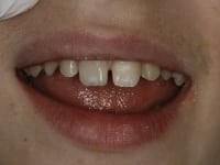 Konig Center for Cosmetic & Comprehensive Dentistry smile photos